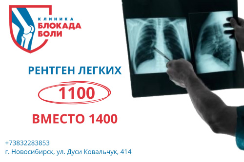 Акция "Рентген лёгких по сниженной цене"